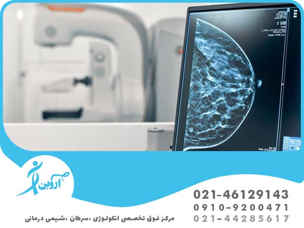 غربالگری سرطان سینه با ماموگرافی