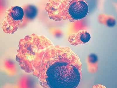 چگونه سلول سرطان در بدن ایجاد می شود
