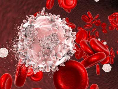 بهترین متخصص خون و انکولوژی و مرکز درمانی - آروین کلینیک